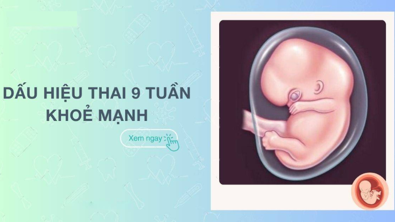 dấu hiệu thai 9 tuần khoẻ mạnh